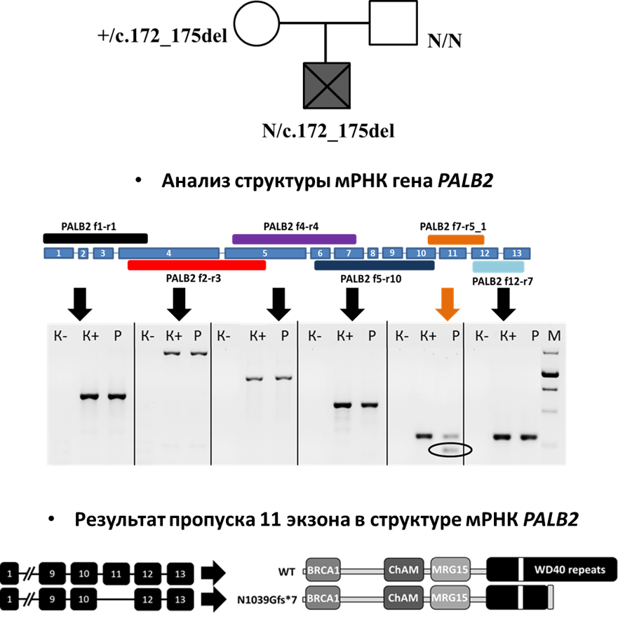 Поиск патогенных вариантов в гене PALB2 методом экспрессионного анализа