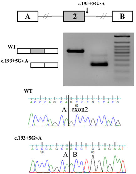 Функциональный анализ варианта с.193+5G>A в гене C19orf12